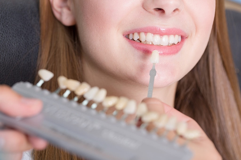Lumineers vs. Veneers: What's the Difference?