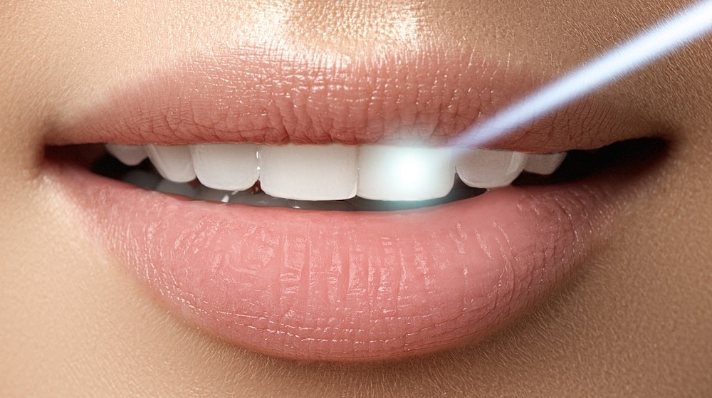 The Many Benefits of Laser Gum Surgery