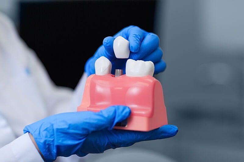 Will It Hurt Having Dental Implants Placed?