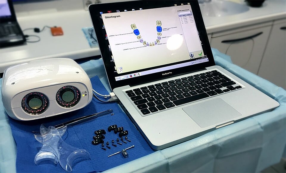 Dental equipment with laptop and odontogram displayed.